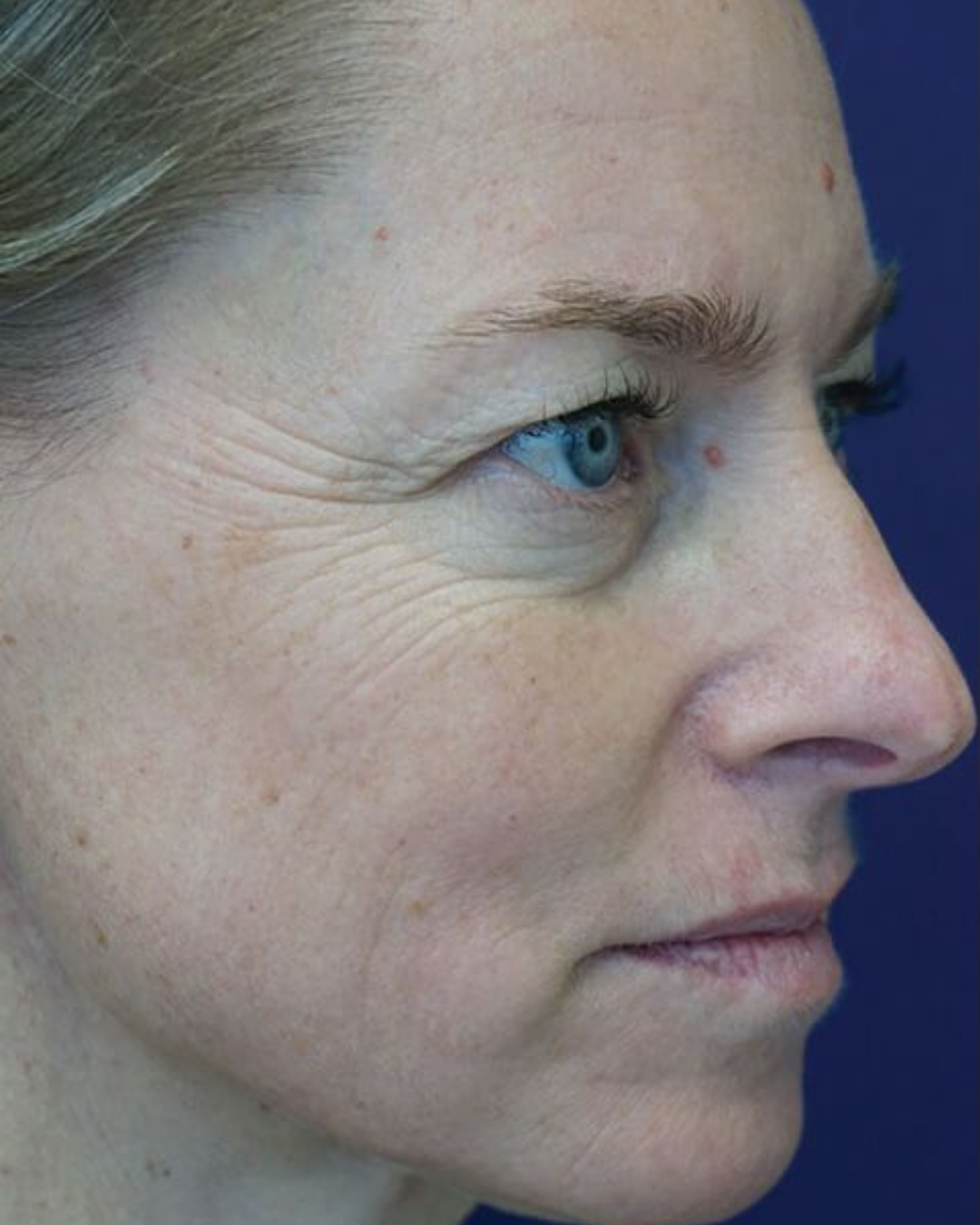 Avant - Claire, 43 ans