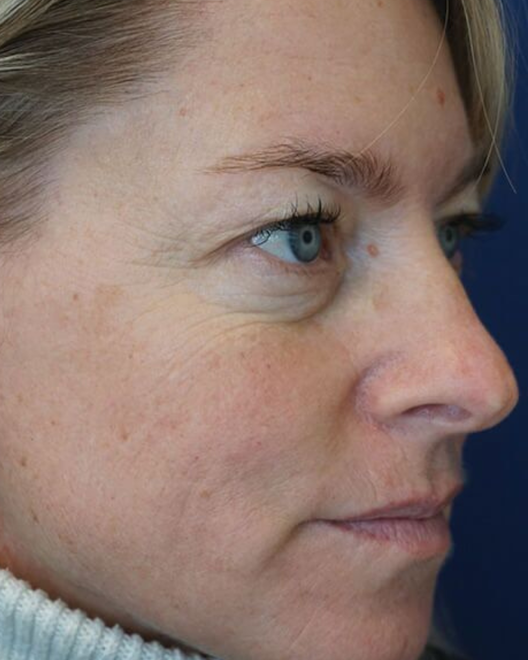 Après - Claire, 43 ans