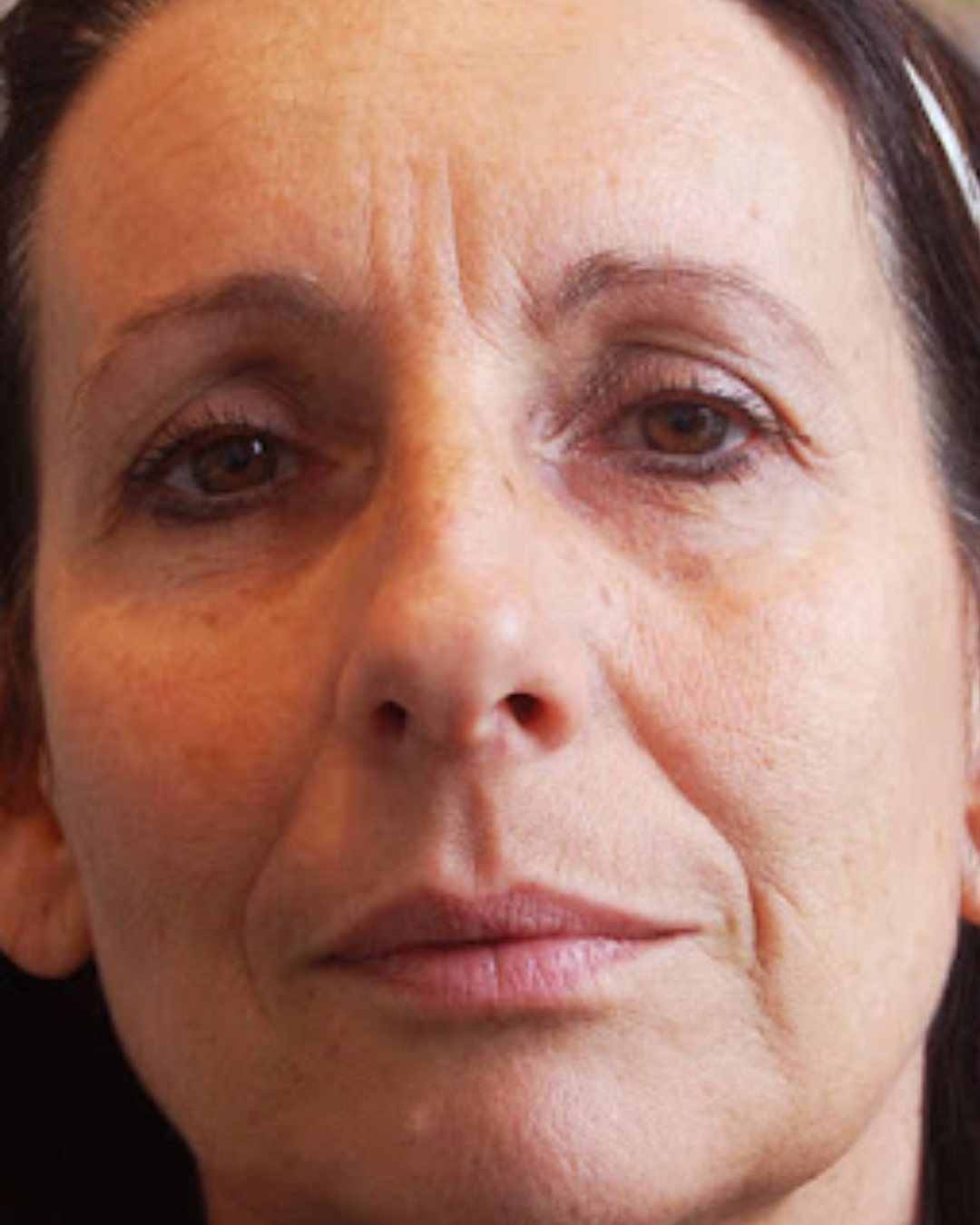 Avant - Nathalie, 47 ans