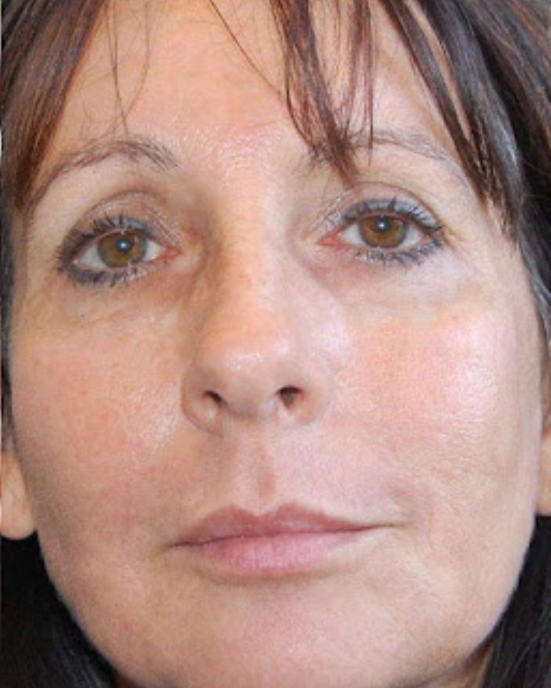 Après - Nathalie, 47 ans