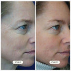 Masque Visage LED Lift+ luvoria