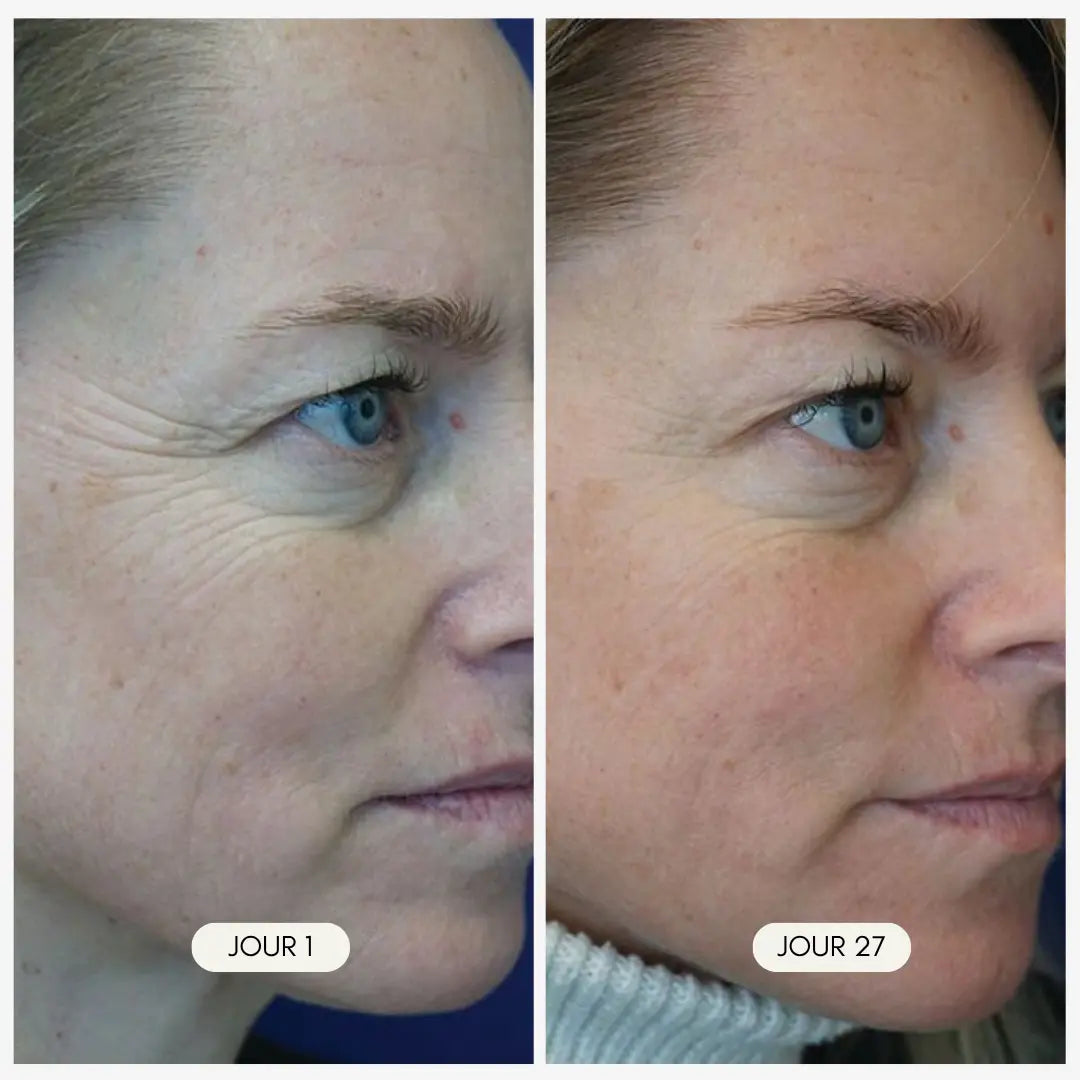 Masque Visage LED Lift+ luvoria